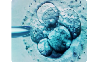 In Vitro Fertilization (IVF)